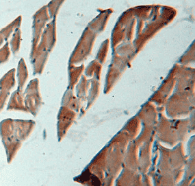 Anti-VAMP2 antibody