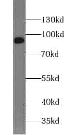 Anti-VCP antibody