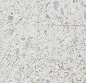 Anti-VGAT antibody