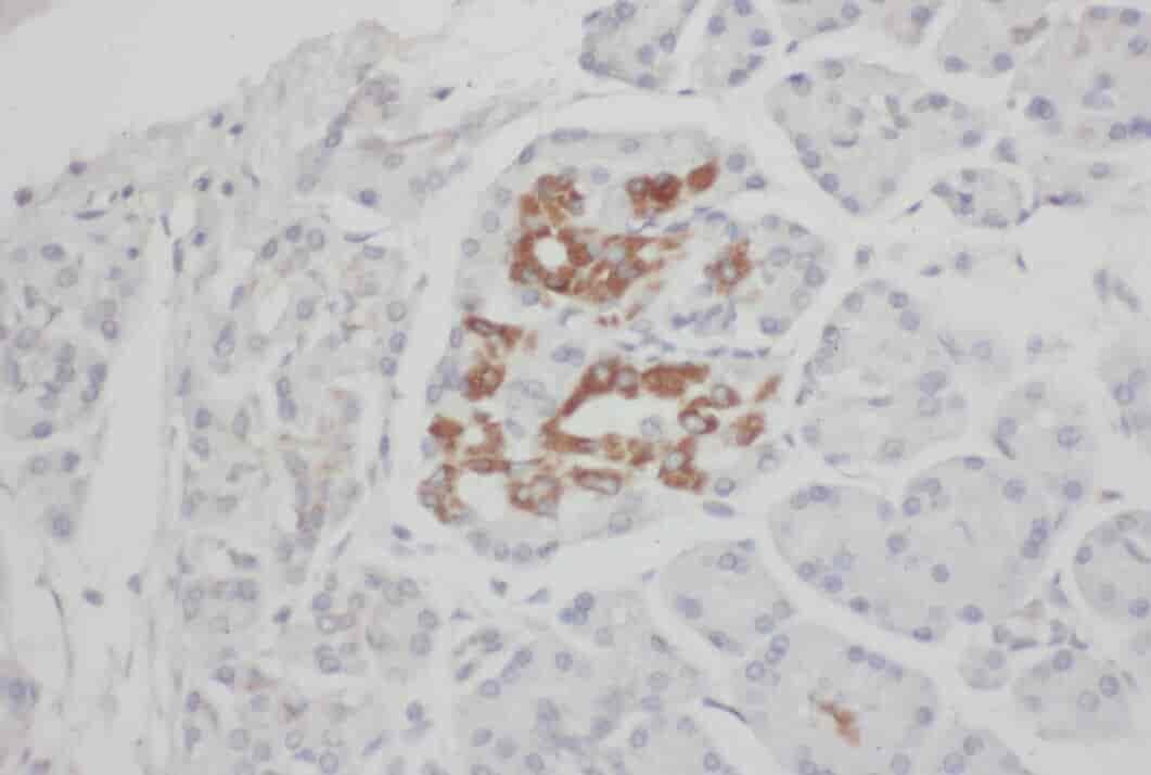 Anti-VWA1 antibody