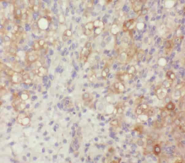 Anti-ZER1 antibody