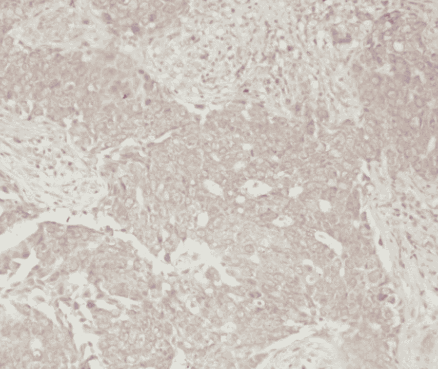 Anti-p70S6K antibody