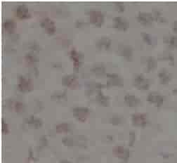 sumo antibody